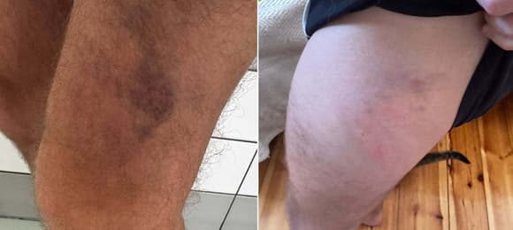 „Kopał mnie i wyzywał od pedałów”. Dla policji to pobicie jak każde inne