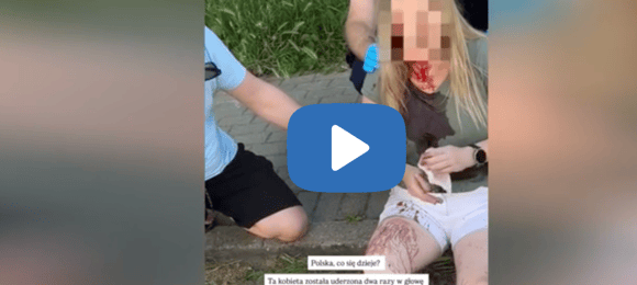 Uderzył ją drewnianą laską w głowę, dwa razy. Ukrainka zaatakowana w Gdyni