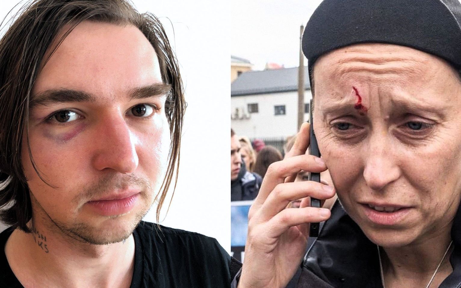 Grafika do artykułu Policja w Lublinie: podczas marszu nikt nie został ranny. Nikt poza dziennikarzami OKO.press