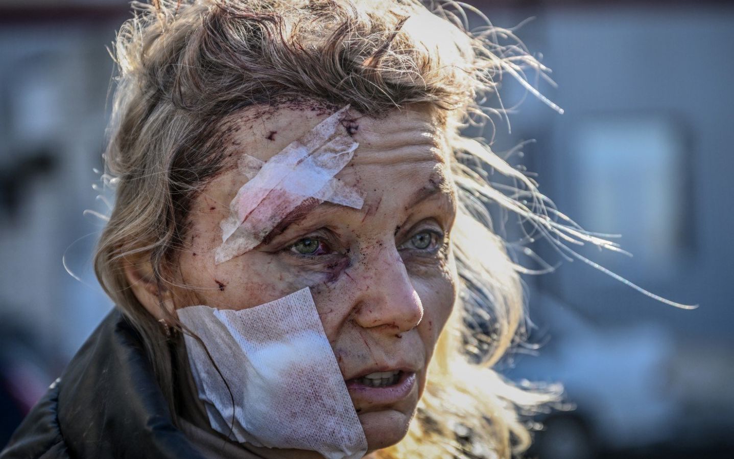A wounded woman stands outside a hospital after the bombing of the eastern Ukraine town of Chuguiv on February 24, 2022, as Russian armed forces attempt to invade Ukraine from several directions, using rocket systems and helicopters to attack Ukrainian position in the south, the border guard service said. - Russia's ground forces crossed into Ukraine from several directions, Ukraine's border guard service said, hours after President Vladimir Putin announced the launch of a major offensive. Russian tanks and other heavy equipment crossed the frontier in several northern regions, as well as from the Kremlin-annexed peninsula of Crimea in the south, the agency said. (Photo by Aris Messinis / AFP)