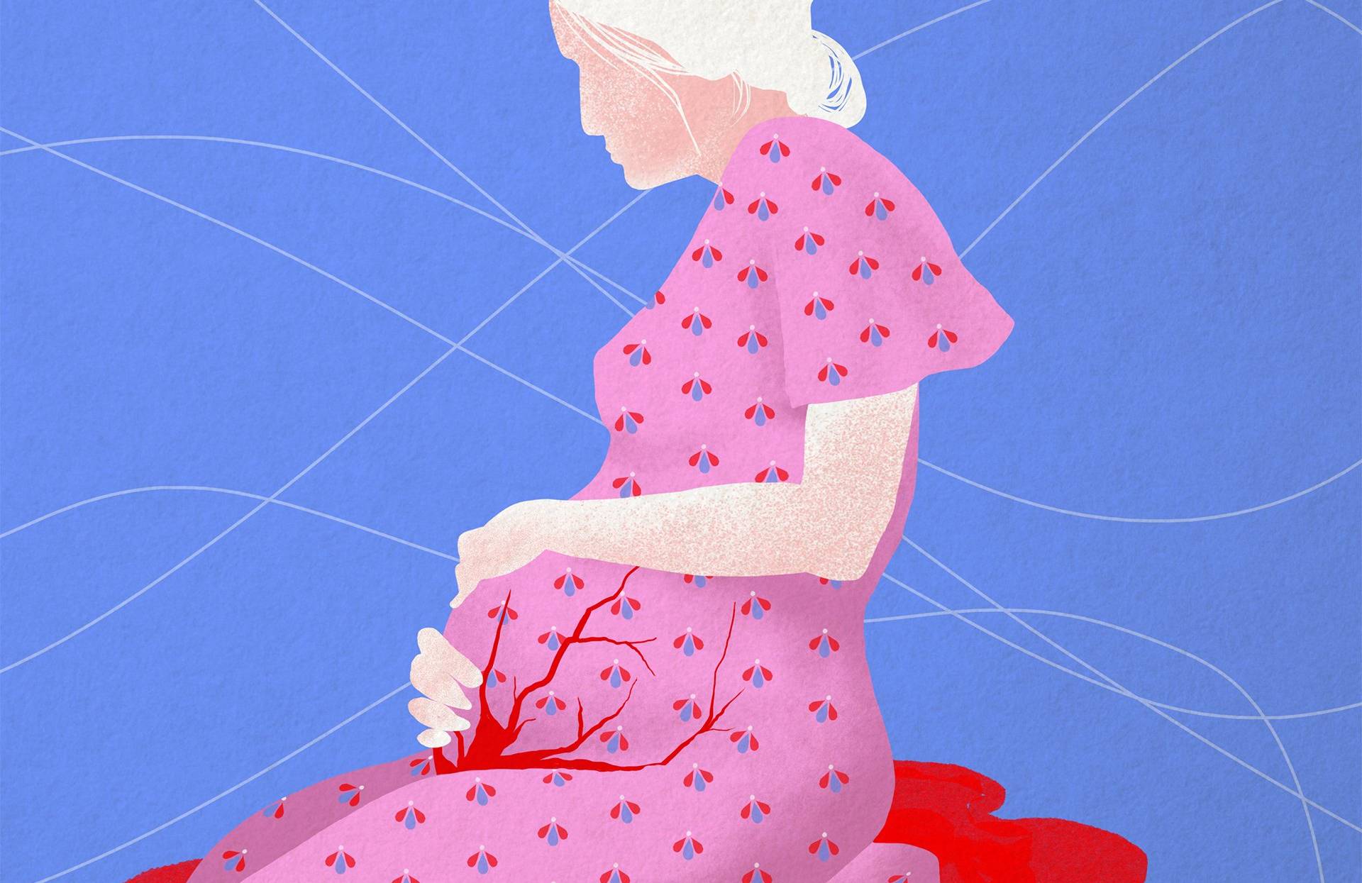 Rysunek: kobieta w sukience w kwiatki, z widoczną ciążą. Obejmuje brzuch, na którym widać czerwone pęknięcia. Poronienie, ciąża.