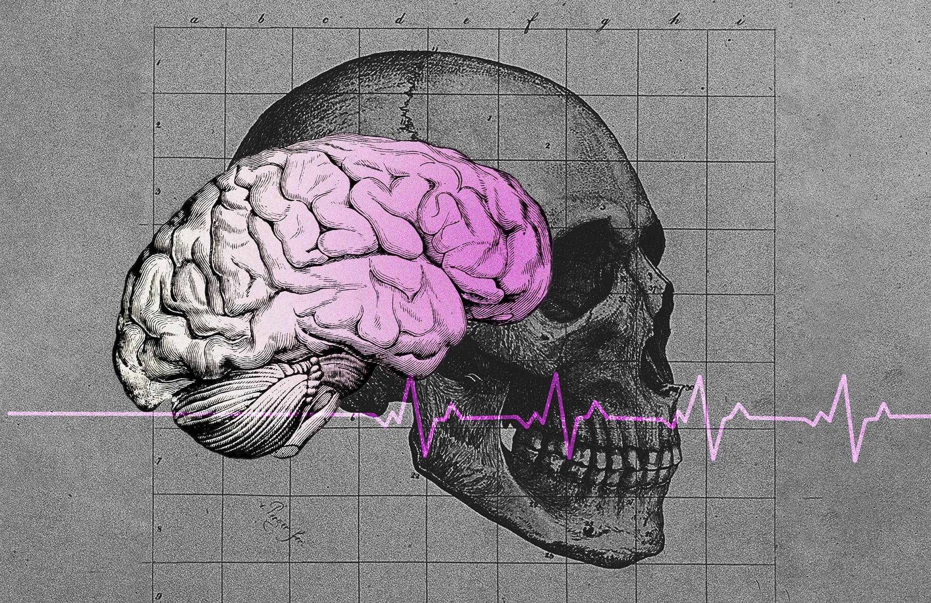 Rycina przedstawiająca mózg, wybarwiony na różowo. W tle czarno-biały rysunek anatomiczny ludzkiej czaszki i różowa linia przedstawiająca wykres biacia serca