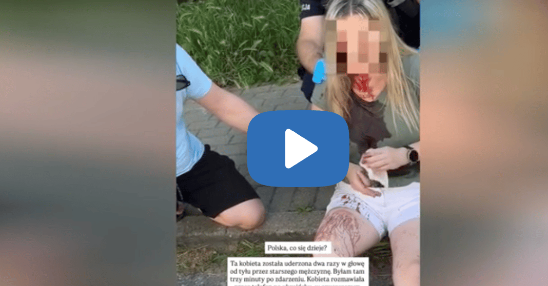 Uderzył ją drewnianą laską w głowę, dwa razy. Ukrainka zaatakowana w Gdyni