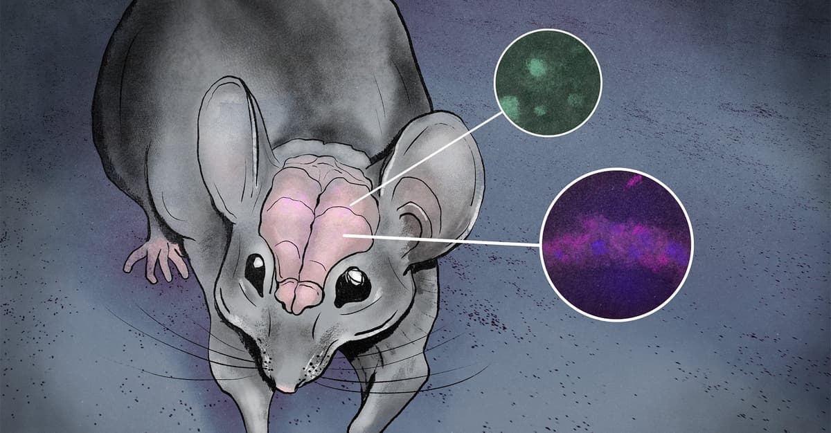 Alzheimer (nadal) wielka zagadka. Czy lit może pomóc?