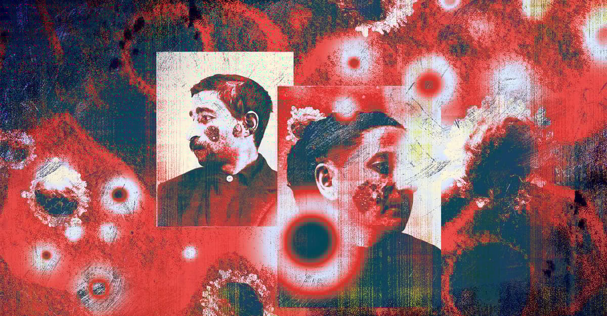 Czy toczeń rumieniowy to jednak choroba wirusowa?