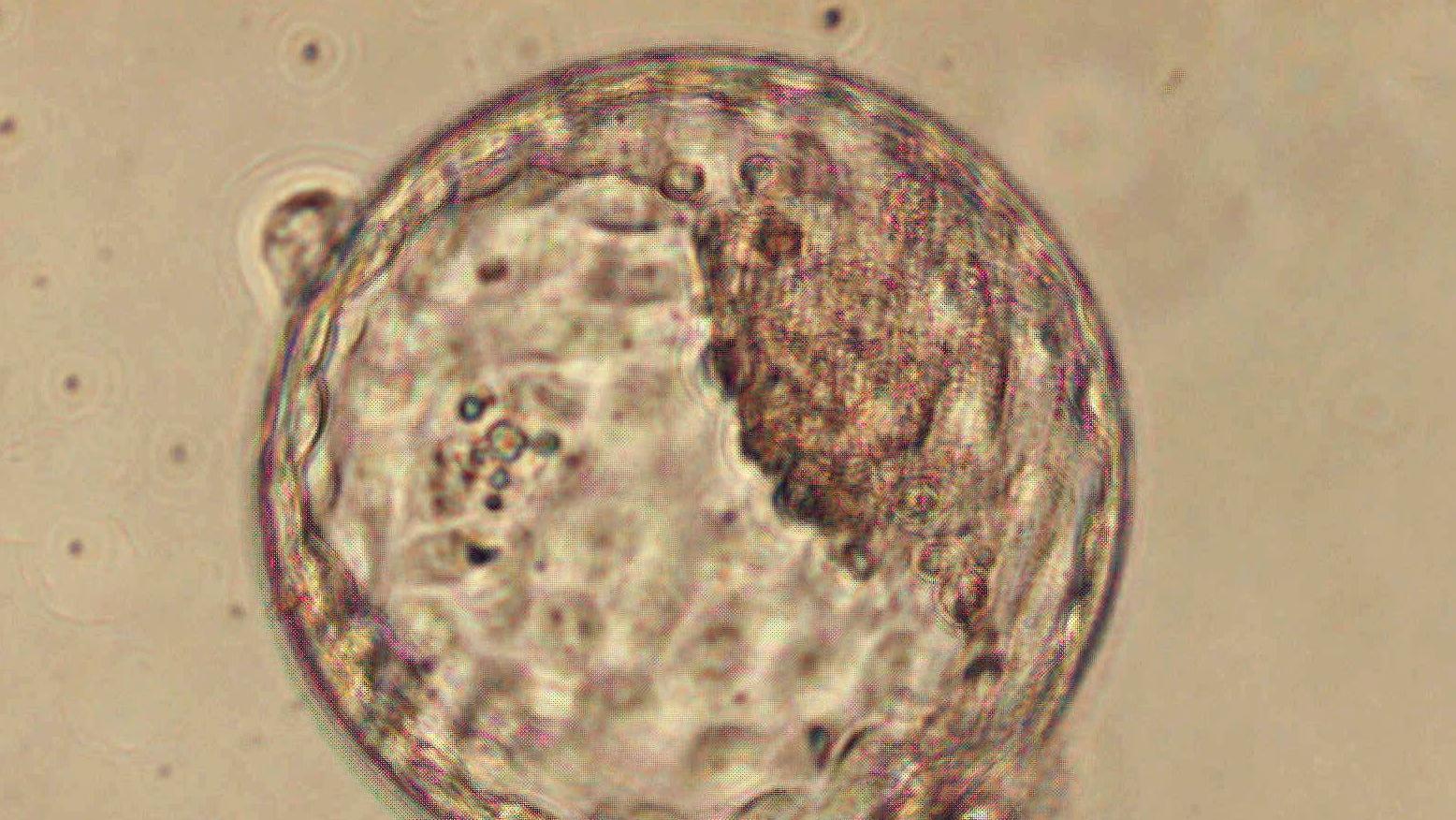Mikroskopowe zdjęcie okrągłej formy, blastocysty
