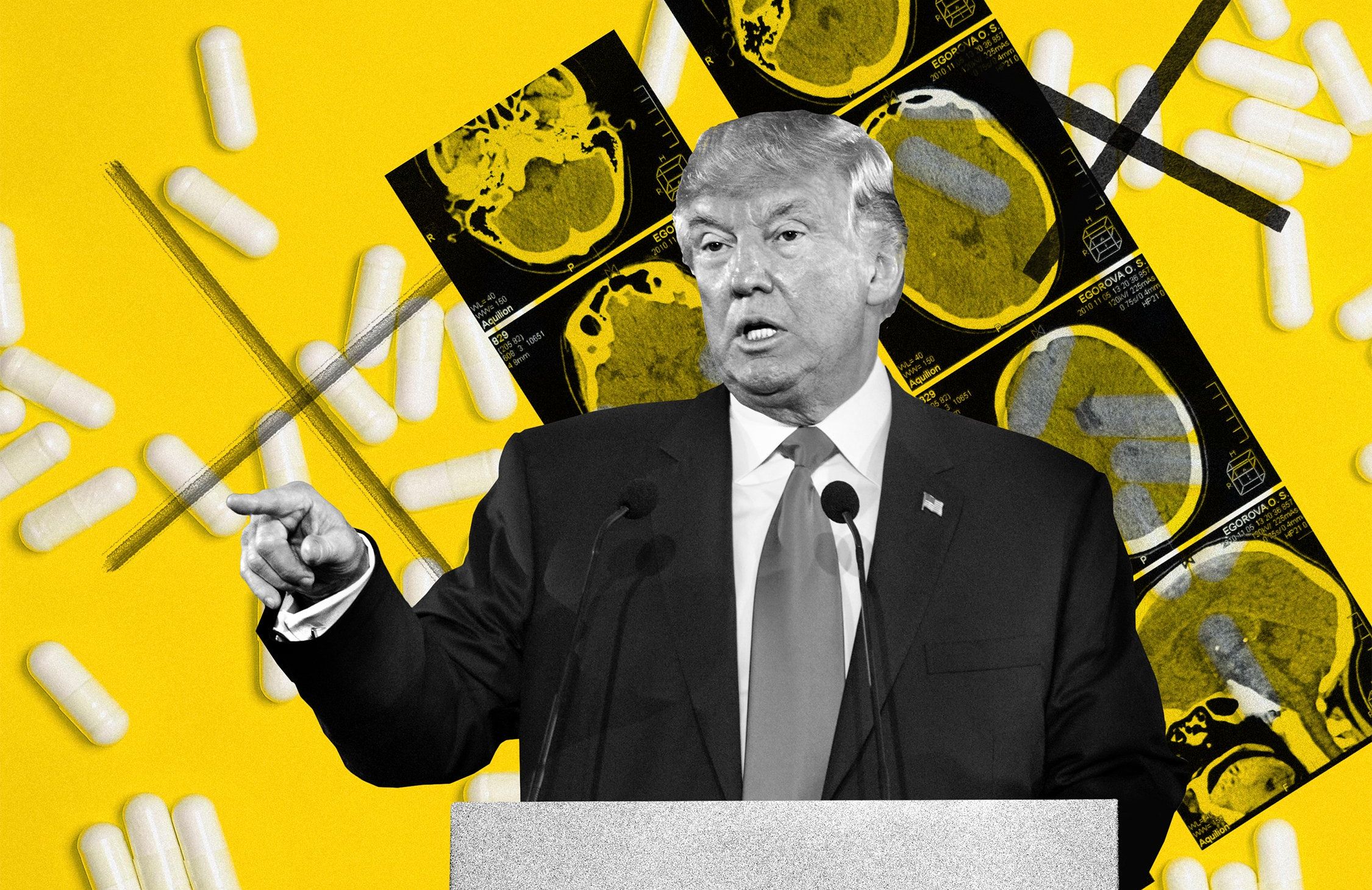 Ilustracja do tekstu o forsowaniu przez Trumpa związku paracetamolu z autyzmem