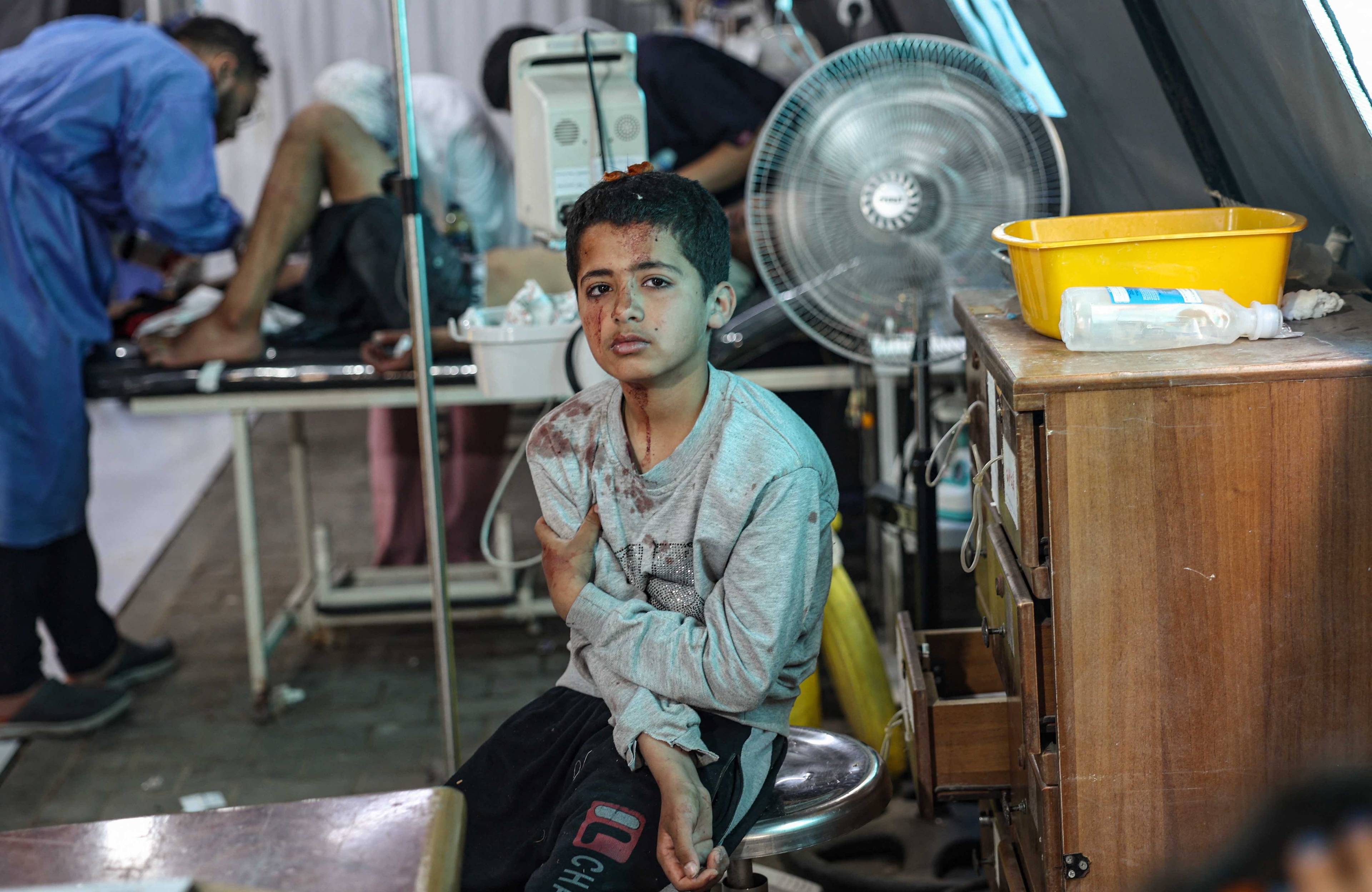 Ranny chłopiec siedzi na stołku i czeka na udzielenie pomocy lekarskiej w szpitalu, w tle widać lekarza zajmującego się pacjentem.Gaza, Rafah.