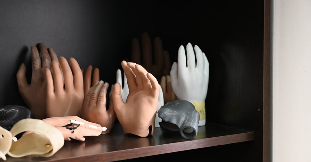 Wojna i jej ofiary. Szpital w Ammanie leczy zmasakrowane twarze i nogi po eksplozjach