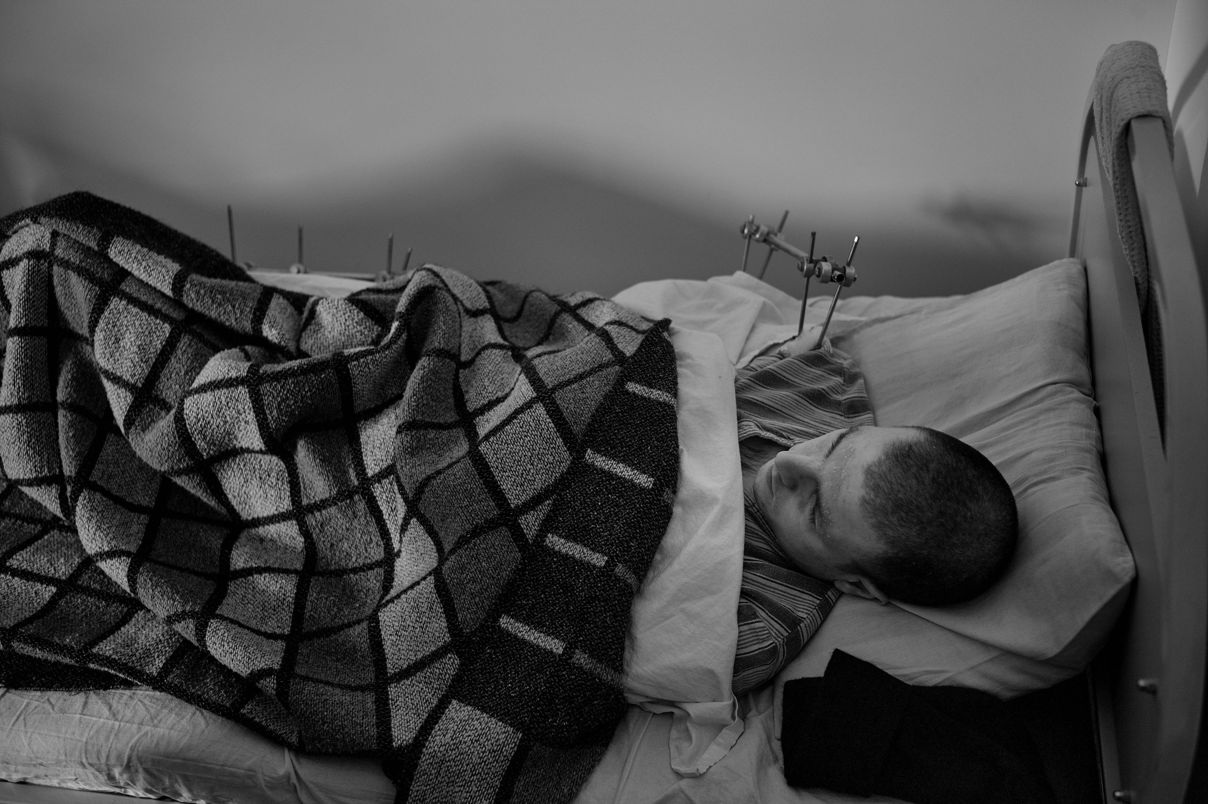 czarno-białe zdjęcie. Mężczyzna krótko ostrzyżony leży w łóżku pod kraciastym kocem. Widać metalową konstrukcje, która mocuje jego ramię