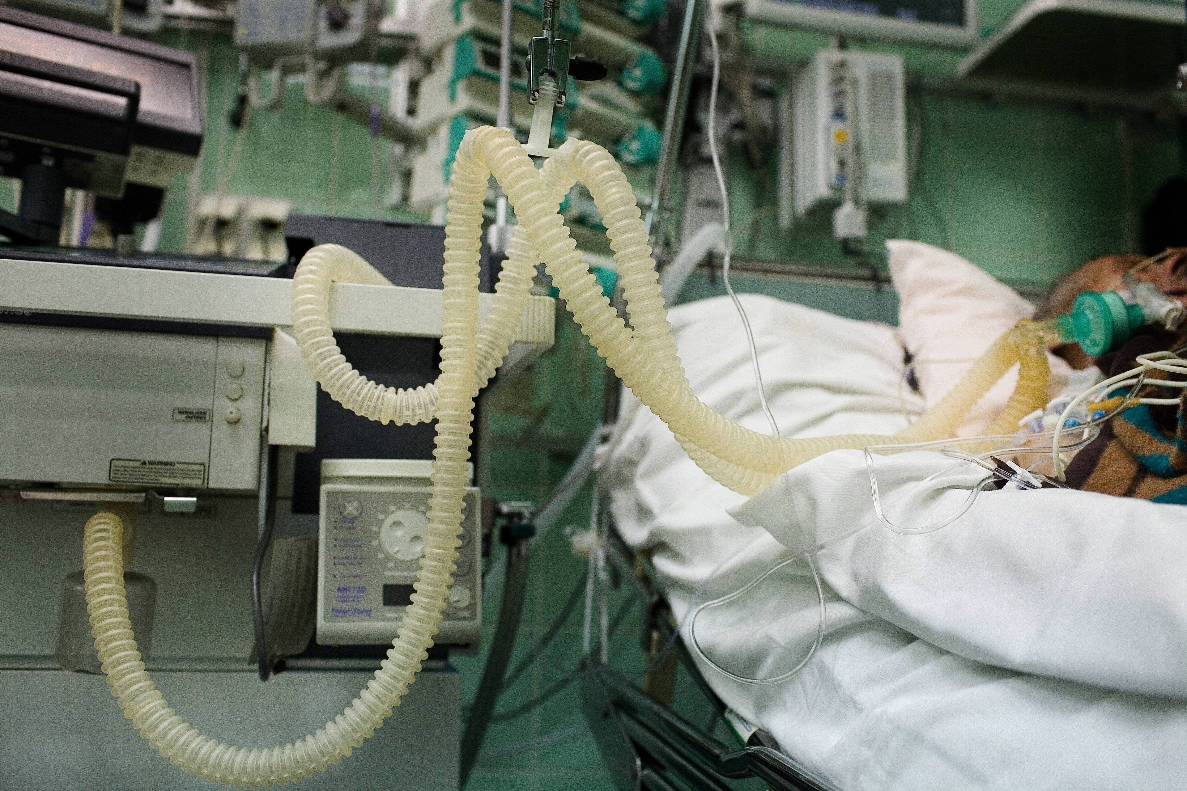 Pacjent w szpitalu podłączony rurkami do urządzeń podtrzymujących życie